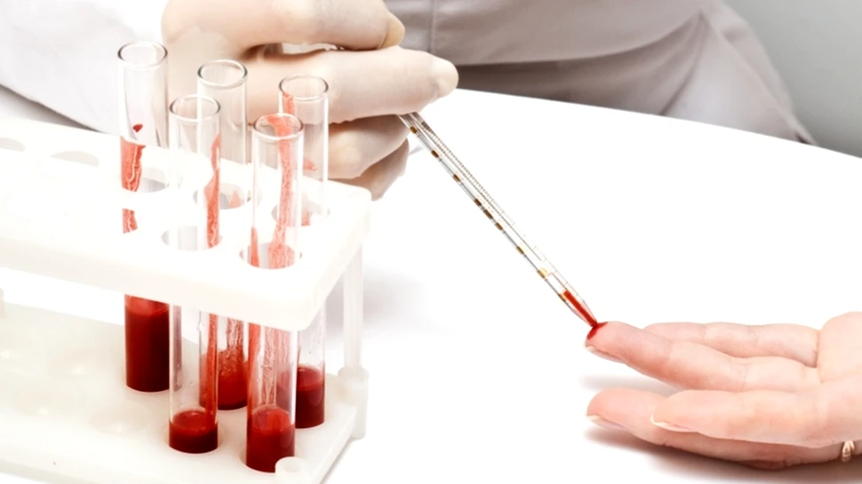 Agentul responsabil de coronavirus, izolat de cercetători canadieni