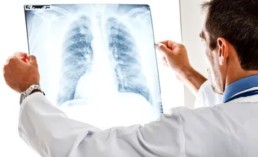 Cancerul pulmonar poate scăpa nedetectat chiar şi 20 de ani înainte de apariţia primelor simptome
