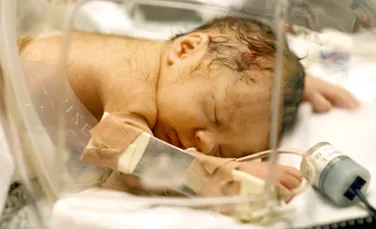 Un bebeluş s-a născut cu o „coadă” lungă de 12 cm. Ce era de fapt această excrescenţă? (FOTO)