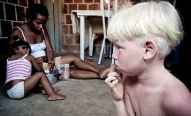 O brazilianca de culoare a nascut trei copii albinosi (FOTO)