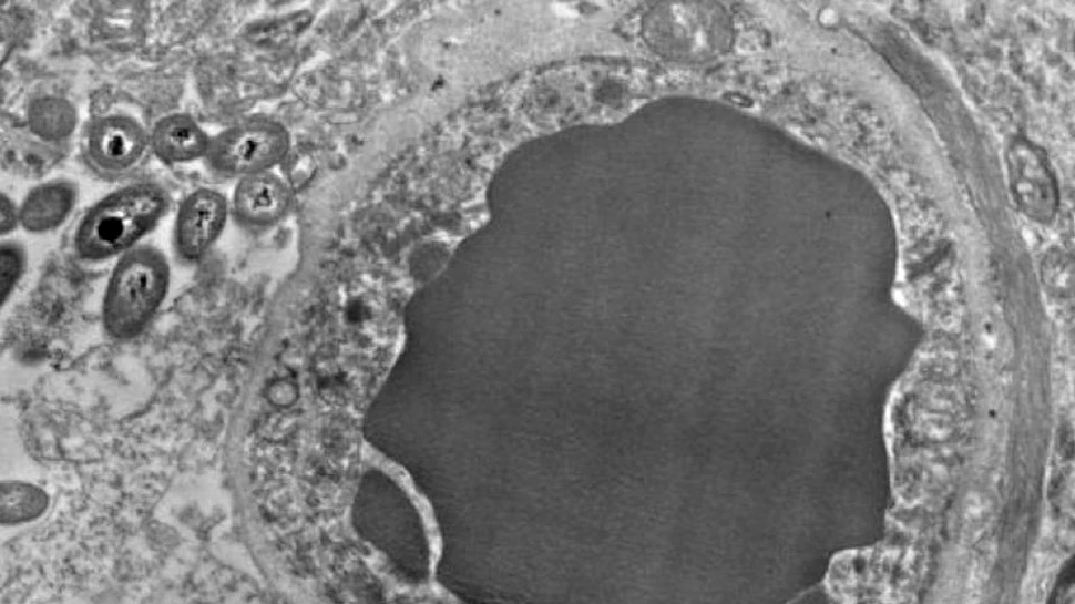 În creierul uman au fost detectate bacterii vii