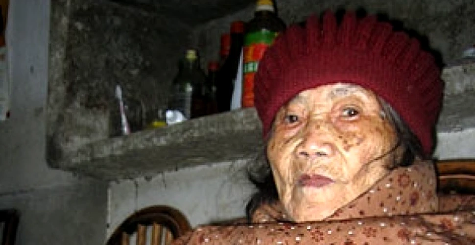 Femeia care a ţinut un făt în pântec timp de 60 de ani