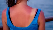 Ce înseamnă SPF, ce este radiația UV și cât de eficiente sunt cremele cu protecție solară