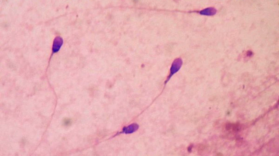 În premieră: spermatozoizi “fabricaţi” în laborator!