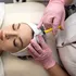 Cum injecțiile cu Botox pot să amelioreze simptomele de depresie sau anxietate