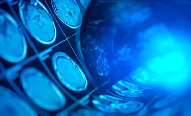 O singură scanare cerebrală poate dezvălui cât de repede îmbătrânești