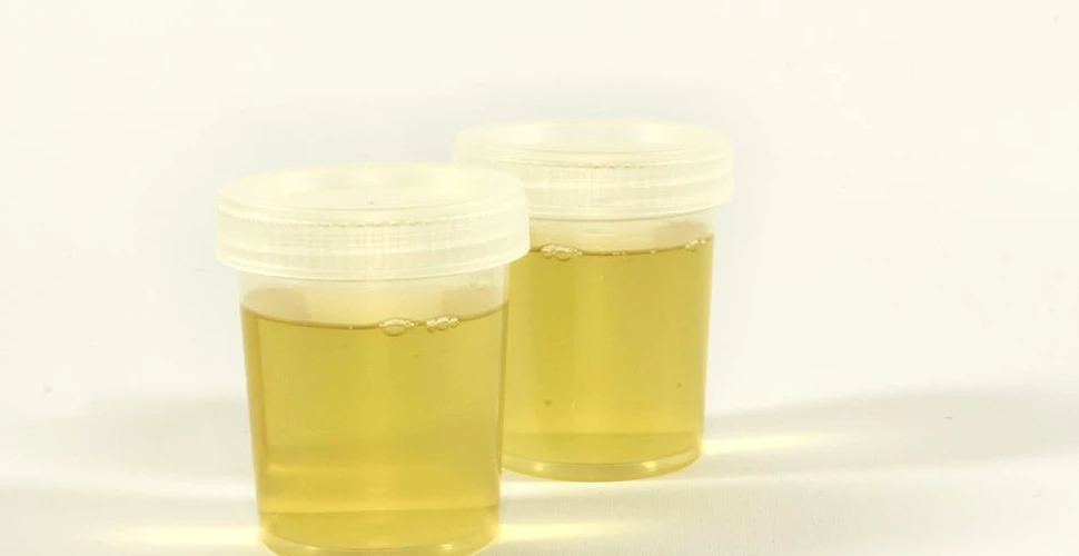 Organismul unei femei din SUA produce singur alcool prin urină. Este primul caz documentat
