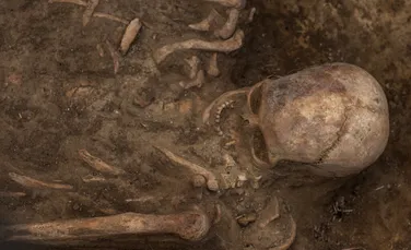„Vezică biliară de porțelan”, găsită într-un mormânt vechi de 100 de ani