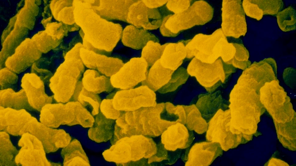 O bacterie mortală infectează copiii de peste 1.400 de ani