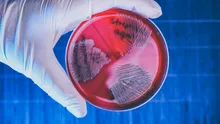 Creștere alarmantă în Japonia! O bacterie rară care poate provoca moartea în 48 de ore
