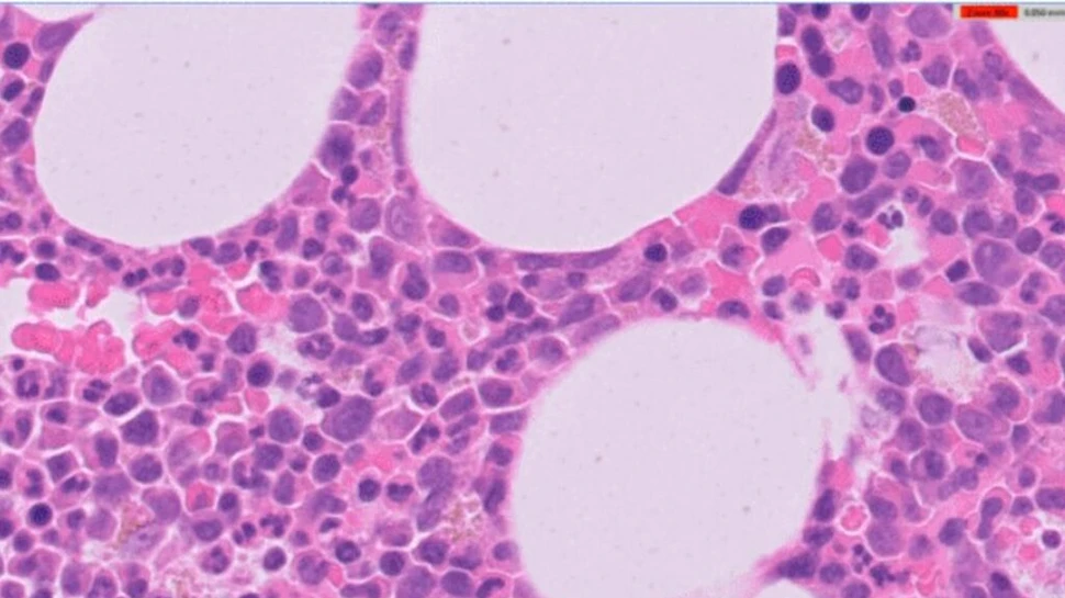 Cercetătorii au creat mini-măduva osoasă în laborator pentru tratamente anti-cancer
