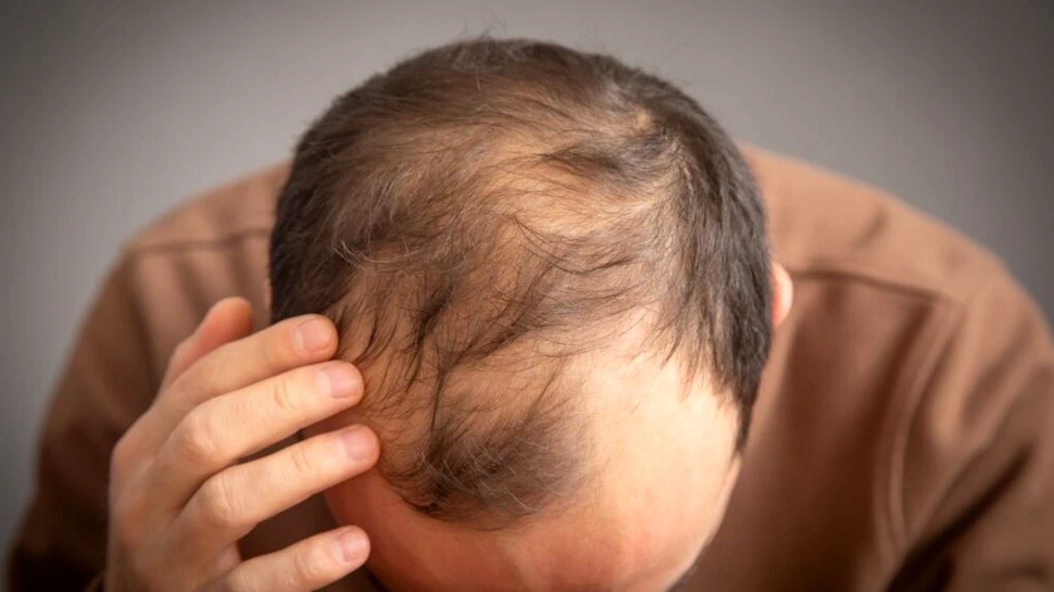O nouă terapie cu lumină ar putea combate căderea părului