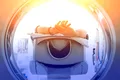 Metoda ultra-rapidă împotriva cancerului care ar putea înlocui radioterapia convențională