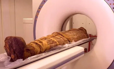 Chiar şi mumiile sufereau de ateroscleroză! Descoperirea schimbă ceea ce credeau medicii despre această maladie