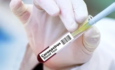 UE ar putea autoriza anul acesta primul vaccin anti-COVID-19