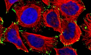 Oamenii de ştiinţă au făcut o nouă descoperire crucială: CANCERUL pancreatic este, de fapt, un conglomerat din patru boli distincte. FOTO+VIDEO
