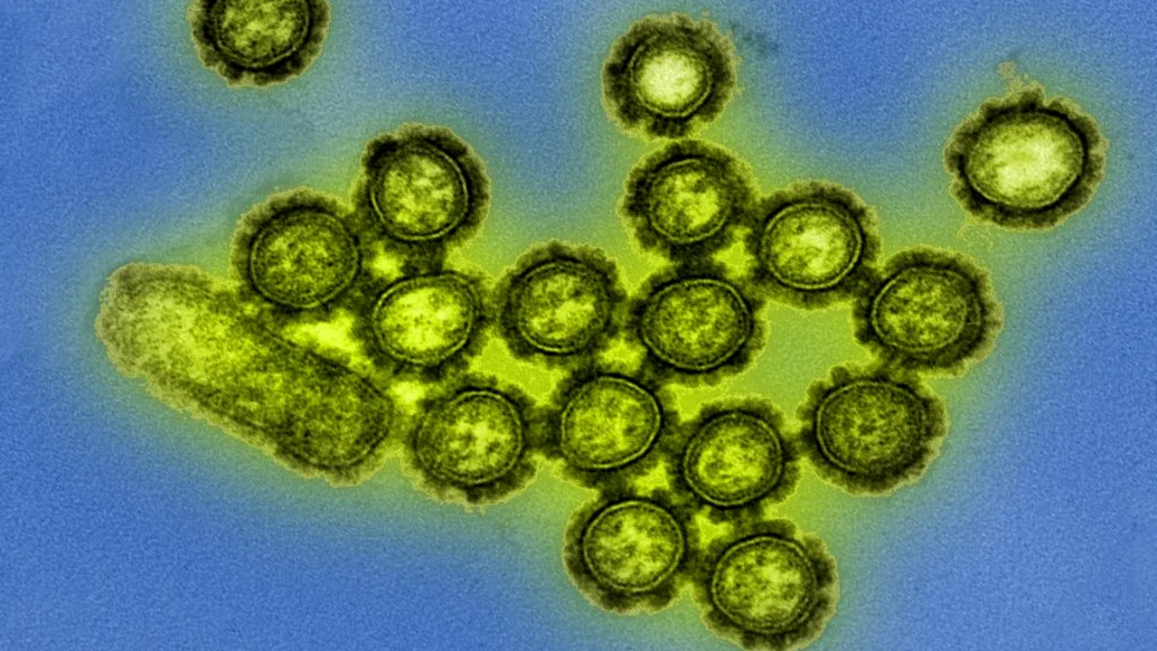 virus-gripa-influenza-H1N1-wiki_descopera 