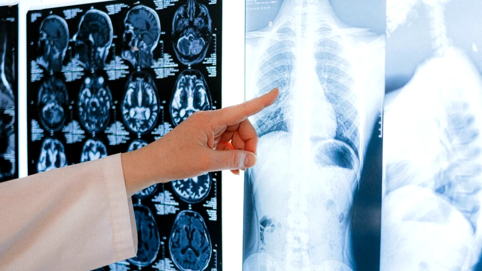 O nouă parte a corpului a fost descoperită. Unde se ascundea aceasta?
