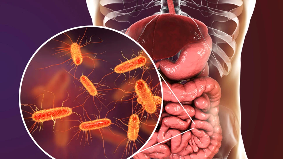 Bacteria E. Coli este sursa a jumătate de milion de infecții urinare