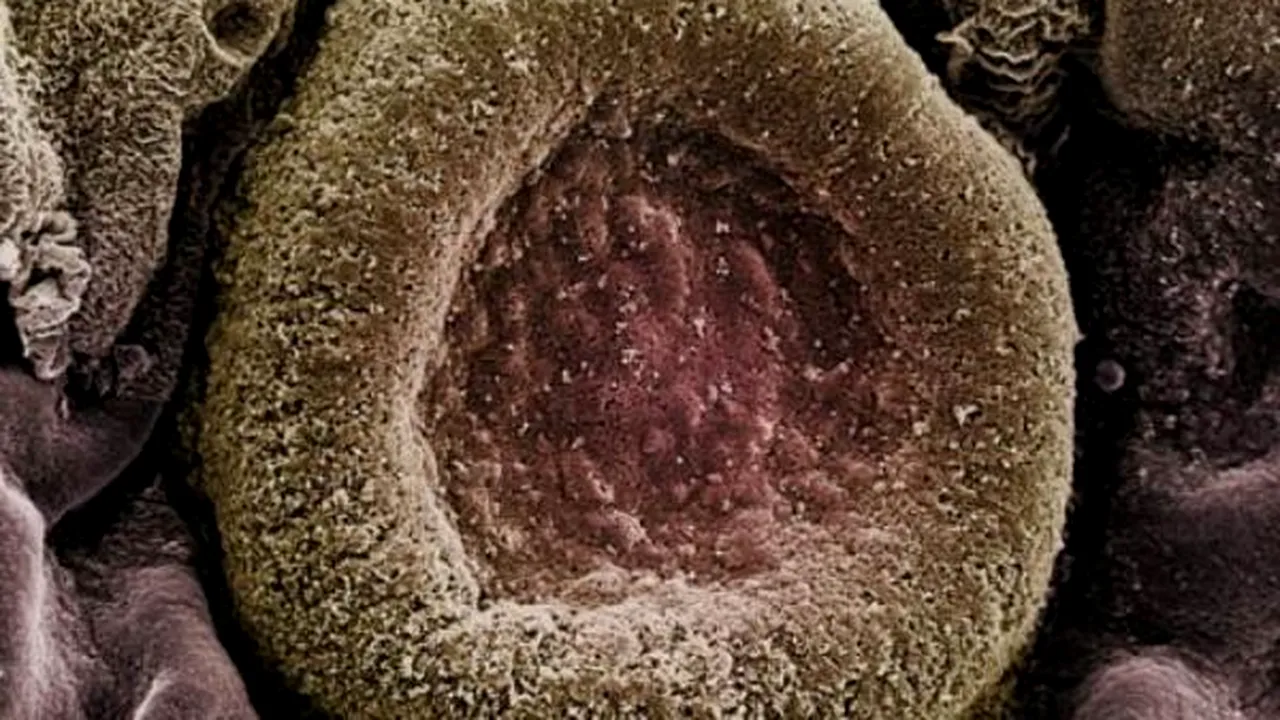 1-streptococcus-pneumoniae 