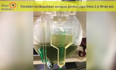 De ce urina unui om poate deveni verde?
