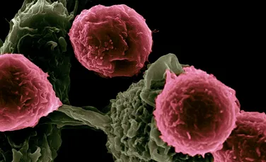 Cercetătorii au descoperit cum să încetinească creșterea celulelor de cancer mamar