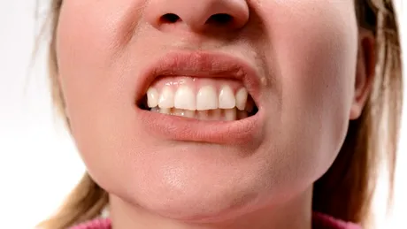 Ce se întâmplă cu sistemul imunitar atunci când ne facem un implant dentar?