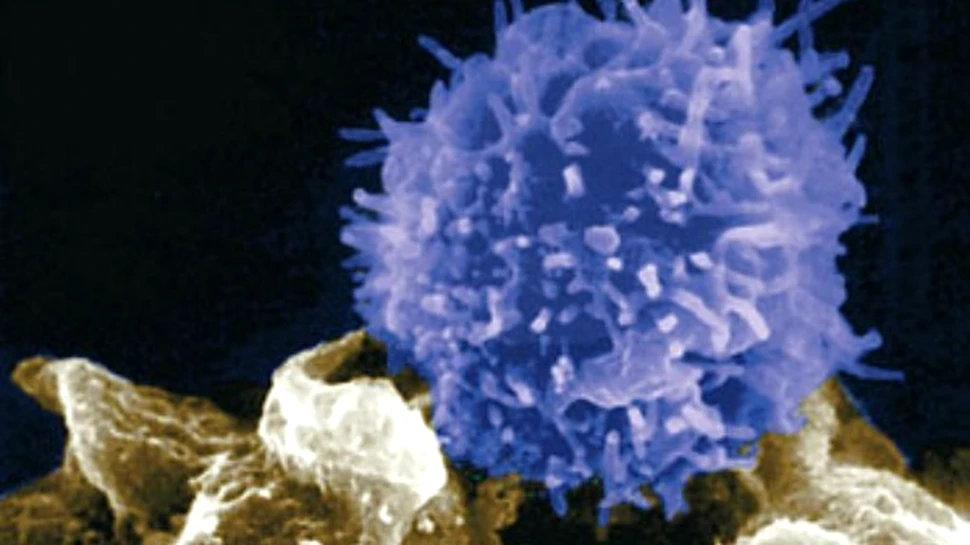 Cand sistemul imunitar este mai rau decat boala