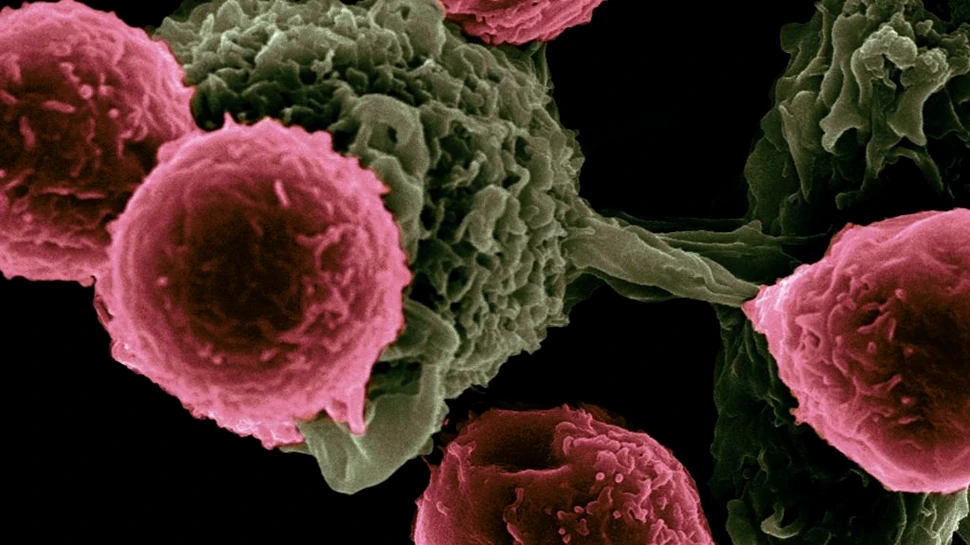 Medicii au descoperit o proteină care face legătura între toate tipurile de cancer