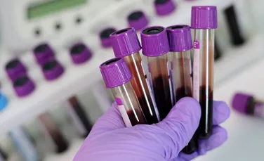Testele pentru un nou vaccin anti-HIV au fost oprite după vaccinarea a 5.000 de oameni