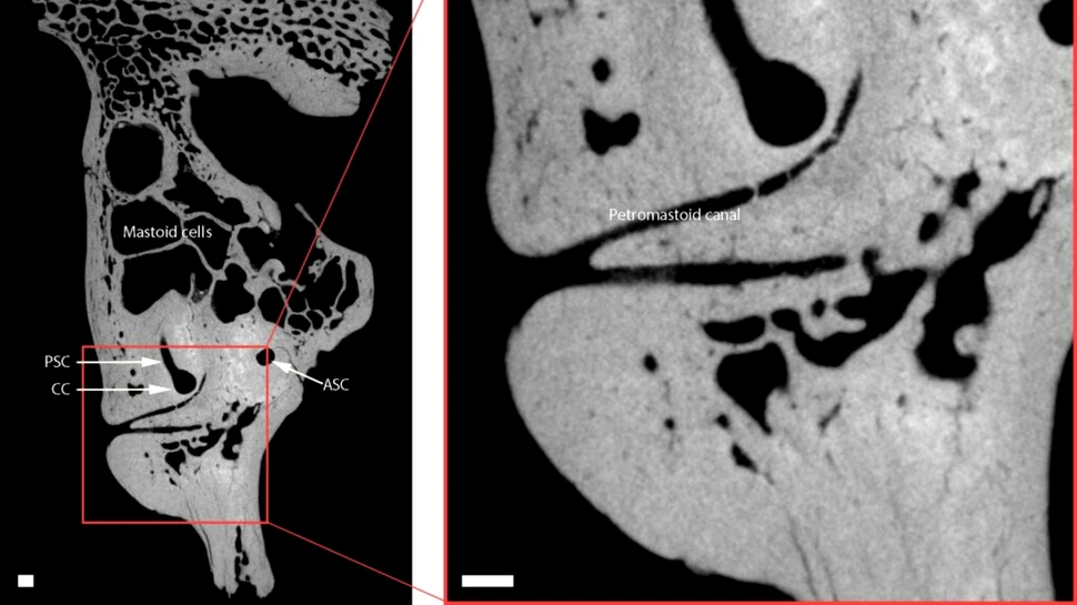 Oasele fosilizate arată cum erau îngrijiți copiii neanderthalieni cu sindrom Down