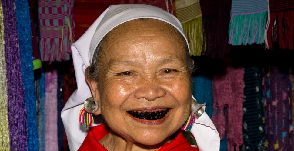 De dragul frumuseţii: cele mai bizare ritualuri de modificare a dinţilor