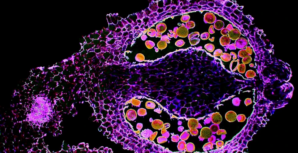 Primul proiect fotografic care ne prezintă celulele aşa cum nu le ştim. Rezultatul este fascinant. FOTO