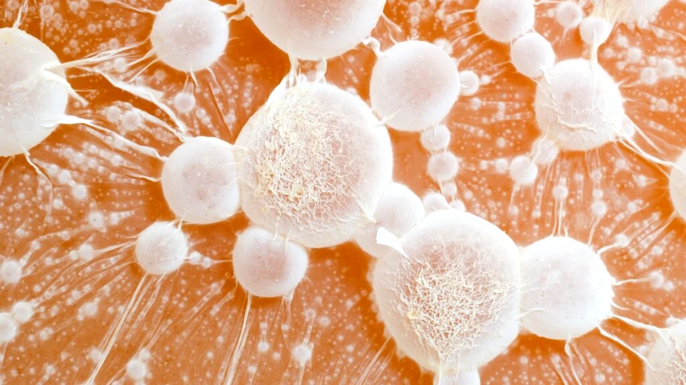 Oamenii de știință au descoperit două gene care ar putea opri răspândirea cancerului