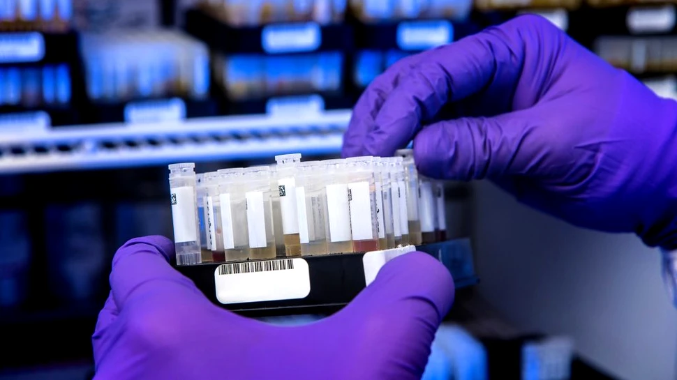 Virusul HIV a fost transformat într-o terapie care poate trata o boală extrem de periculoasă