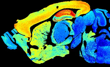 Cum arată creierul pe măsură ce îmbătrânim. Vârsta mijlocie aduce o explozie de culori