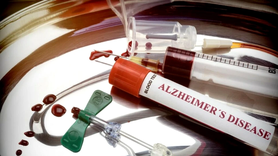 Un test de sânge va putea detecta mai repede boala Alzheimer