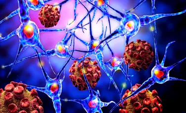 Boala Alzheimer poate proveni din altă parte a corpului şi nu din creier, conform unui rezultat surprinzător