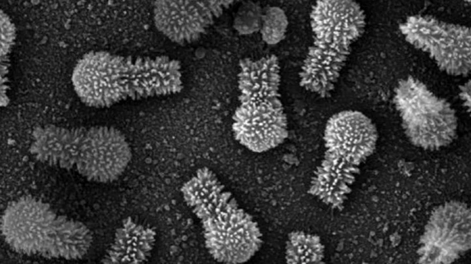 Aceste virusuri recent descoperite în Brazilia sunt atât de mari încât schimbă definiţia a ceea ce este considerat un virus