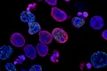 Oamenii de știință au reușit să distrugă celule canceroase cu ajutorul ultrasunetelor
