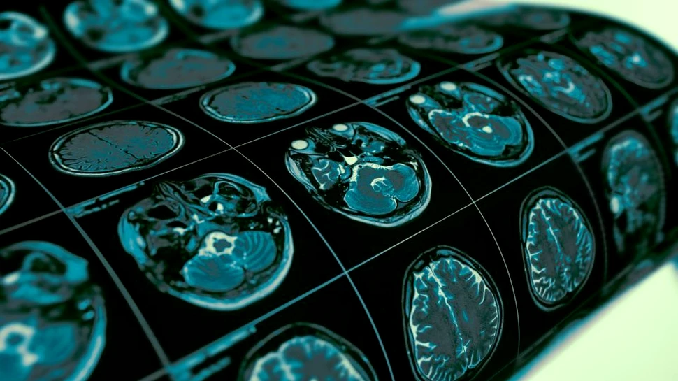 Un studiu nou a identificat ”amprentele” conştienţei în creierul uman