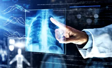 Radiografiile toracice ajută la diagnosticul timpuriu al cancerului pulmonar
