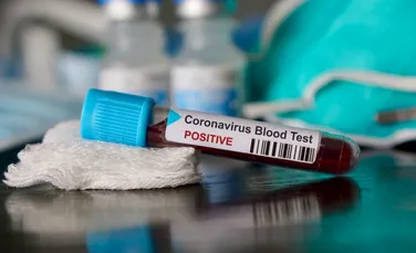 Un potenţial vaccin contra coronavirusului ar putea fi dezvoltat în 16 săptămâni
