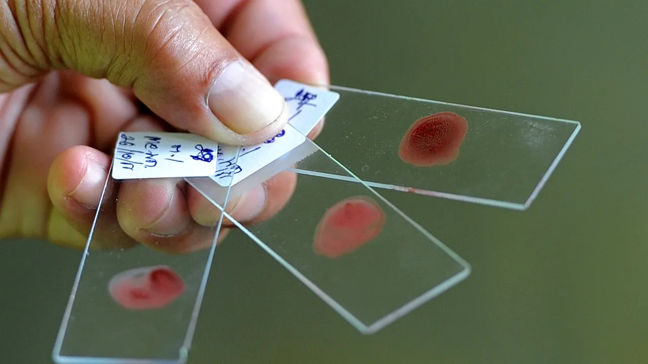 1-malaria 
