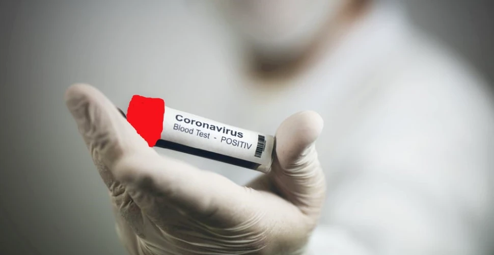 Germania efectuează primele testări masive din Europa privind anticorpi de coronavirus