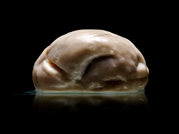 Cel mai neobişnuit creier fotografiat vreodată