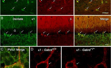 Un medicament a restabilit amintirile pierdute din cauza bolii Alzheimer