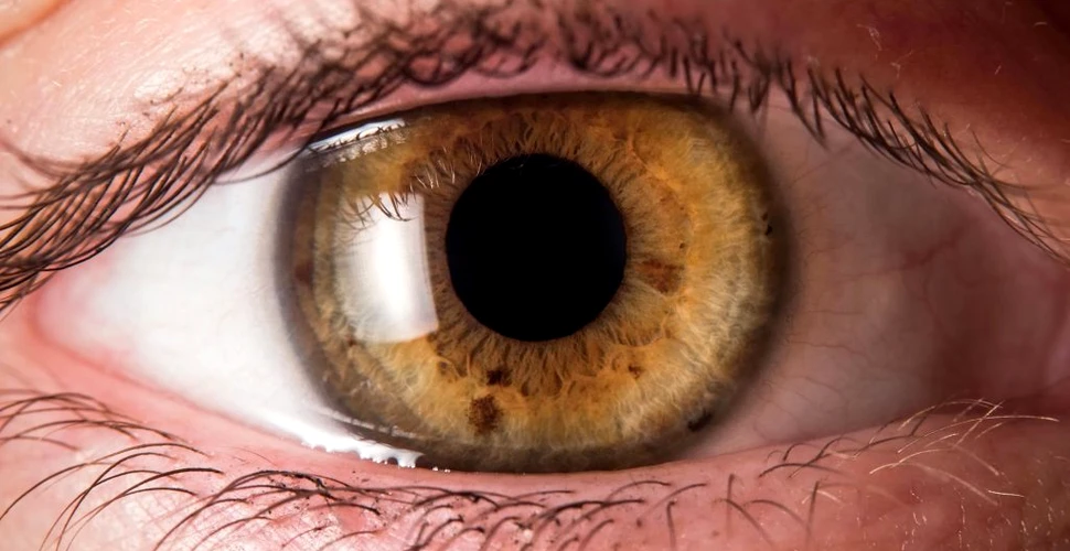 Un nou tratament pentru cel mai frecvent cancer la ochi