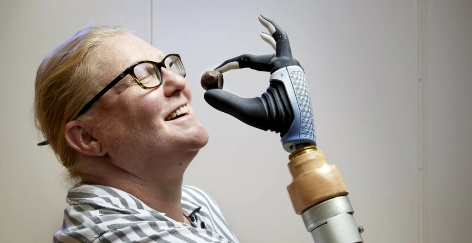 O mână bionică revoluționară a fuzionat cu oasele, mușchii și nervii unei femei