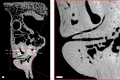 Oasele fosilizate arată cum erau îngrijiți copiii neanderthalieni cu sindrom Down